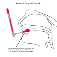 TonguePRESS® - Image 3